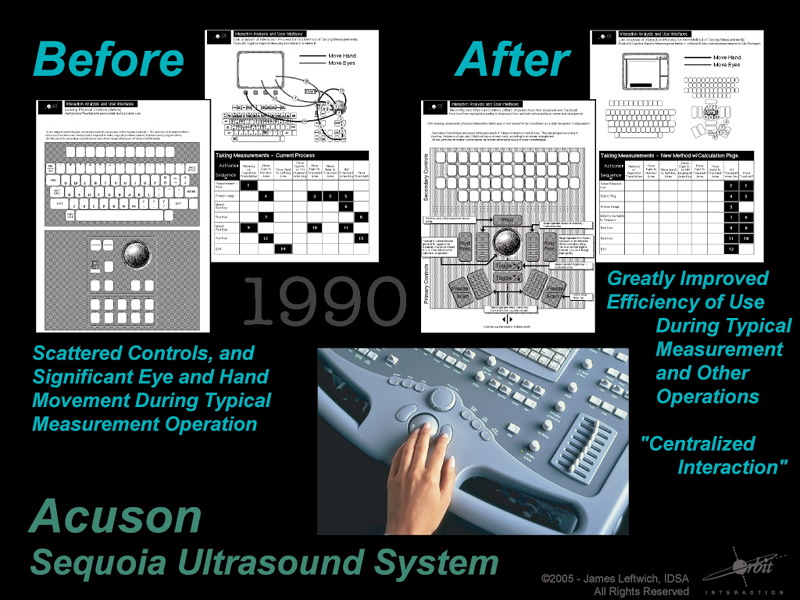 031_IAOT_Acuson2