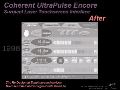 056_IAOT_CoherentUltrapulse3